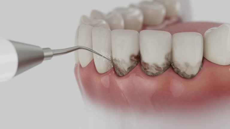 Trusted Teeth Cleaning And Checkup service in Ephrata, WA - Dentist Open Now